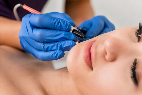 Electrolysis